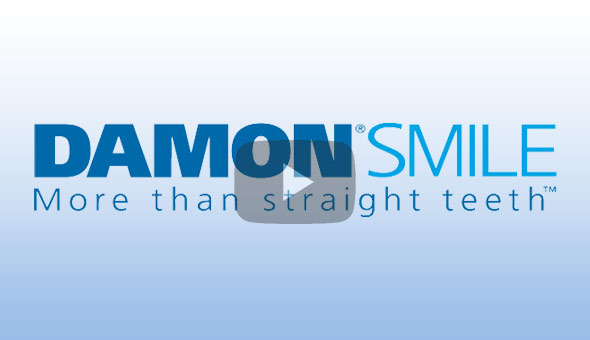 Damon System More than straight teeth Video